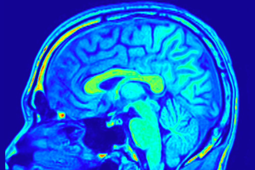 Turns out the human mind sees what it wants to see, not what you actually see