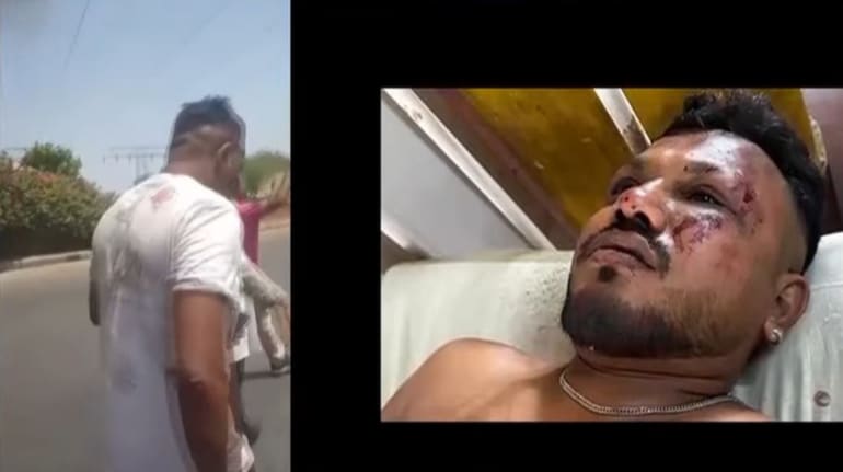 Air India crash: Sole survivor walks away from wreckage. WATCH