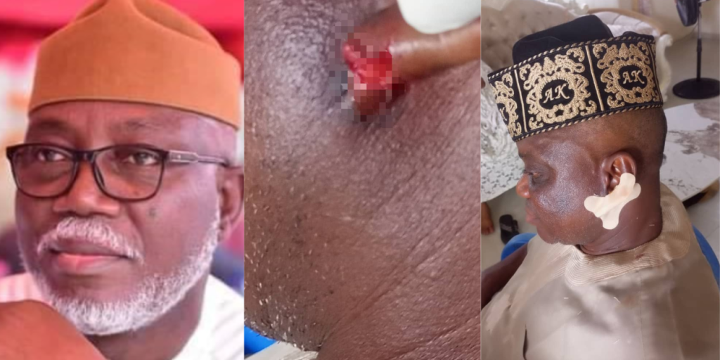 Ondo monarch claims Governor Aiyedatiwa’s elder brother bit off his ear during ceremony