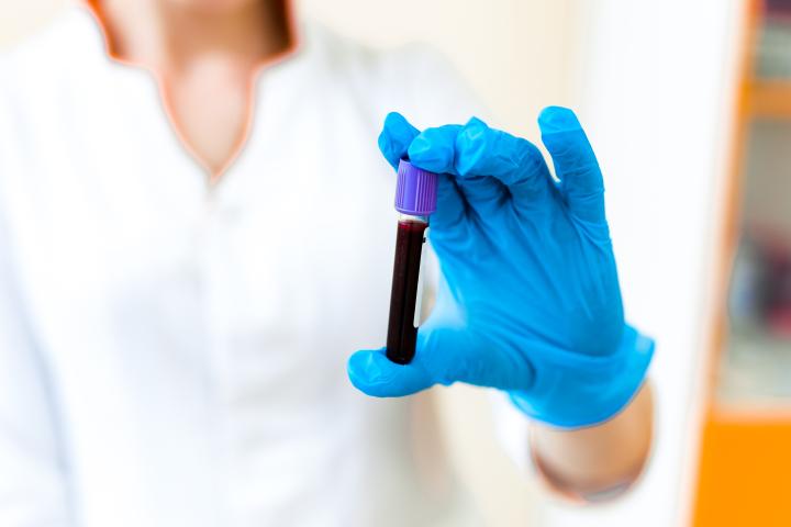 New blood test can detect cancer three years before symptoms appear