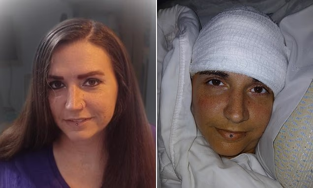 “I wrote my name”: Paralyzed woman uses Musk’s neuralink chip to control computer by thought