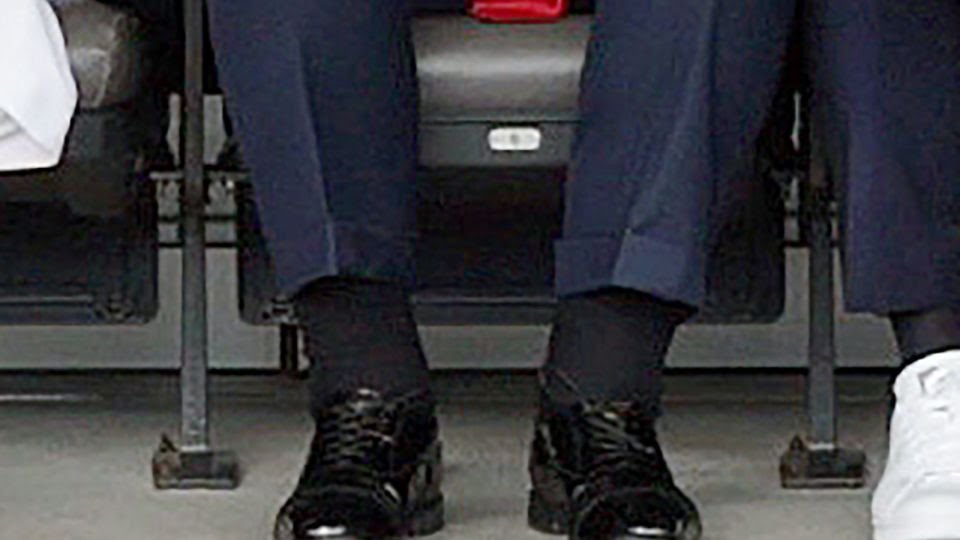 Here’s what to know about chronic venous insufficiency