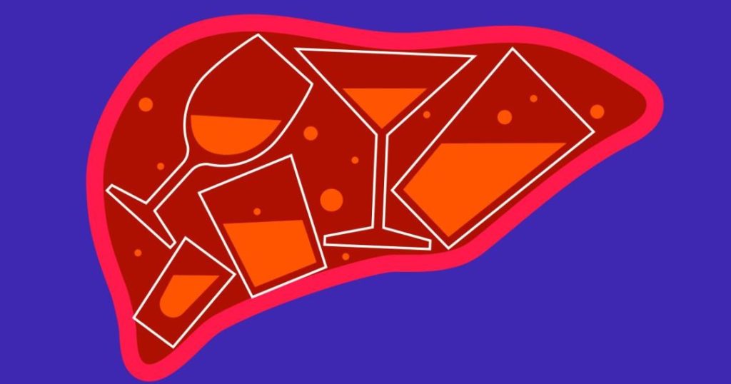 Study finds rising severe liver damage linked to heavy drinking, not higher consumption