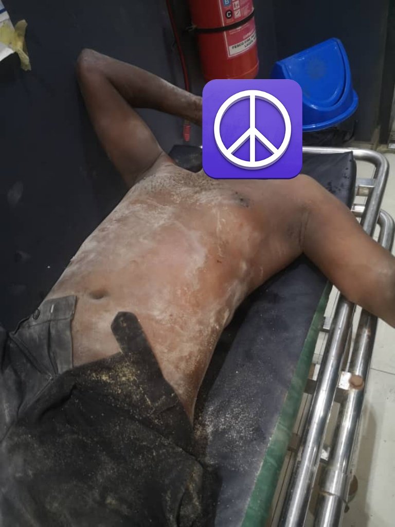 Several injured as building collapses overnight in Lagos