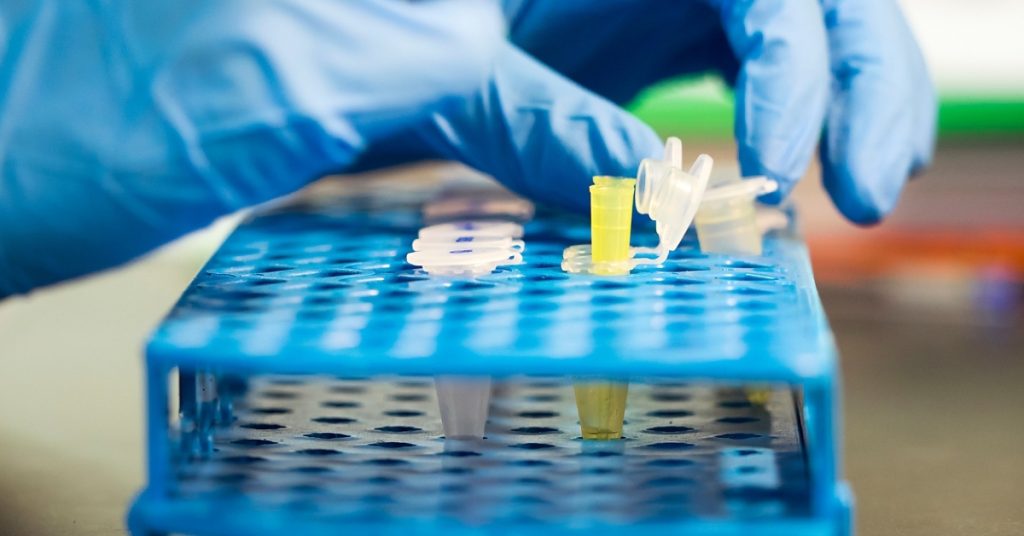 Man forges paternity test to escape 5K child support…