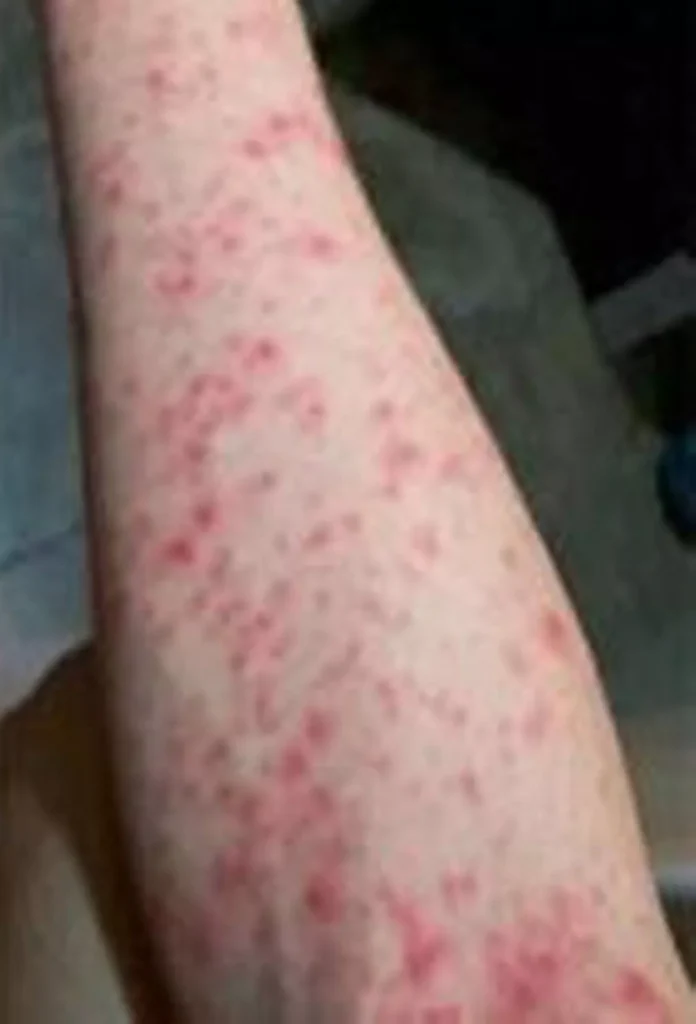 ‘New Chinese pandemic’ spreads to 10,000 cases as horror pictures prompt quarantine