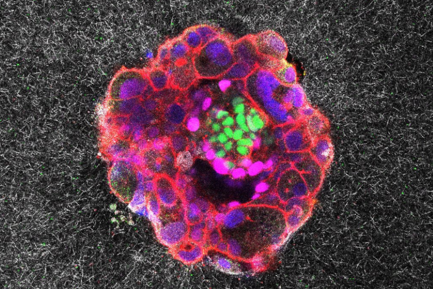 Scientists record real-time human embryo implantation for the first time