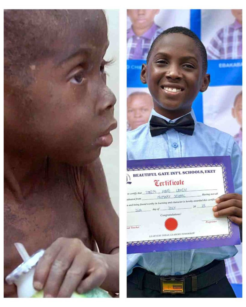 From stigma to success: Nigerian boy once called a witch completes primary education