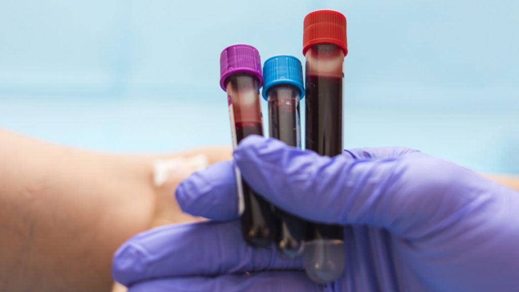 New blood test can detect cancer risk a decade in advance