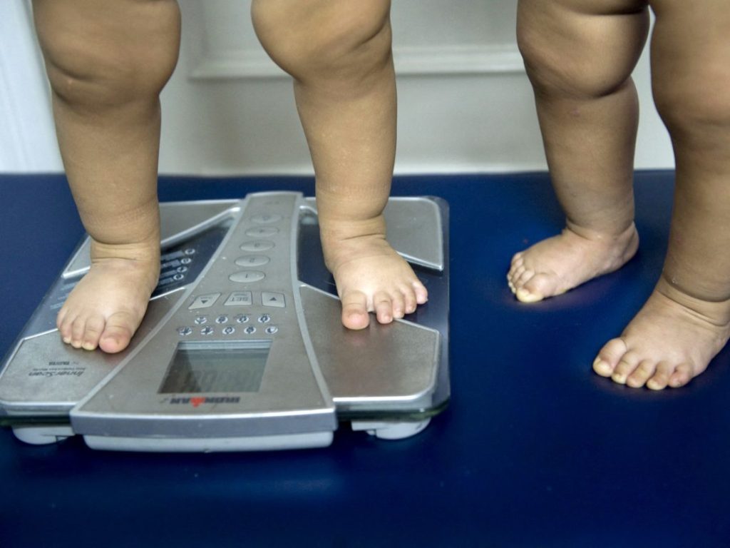 UNICEF: Obesity emerges as leading form of malnutrition among youth