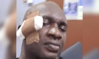Abia Majority Leader allegedly attacks colleague with beer bottle during LP meeting