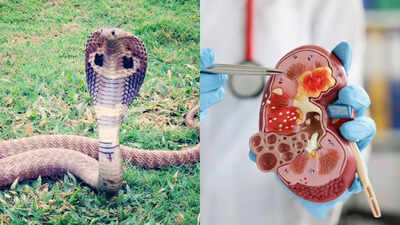 Snake urine could cure kidney stones and gout – Scientists
