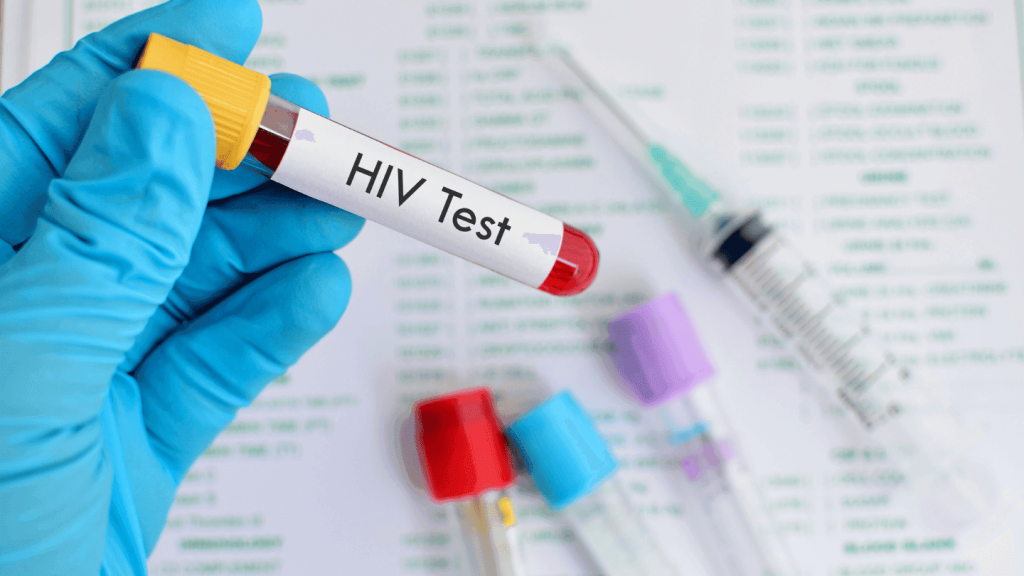 10,430 HIV cases: Lagos figures wrongly read as new infections — NMA 10,430 HIV cases: Lagos figures wrongly read as new infections — NMA